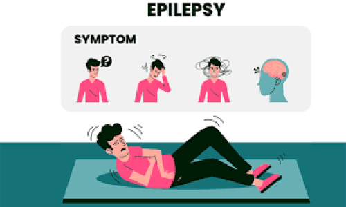epilepsyb frequent fainting  (मिर्गी बार बार बेहोशी)