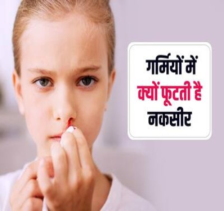 मैं आज आपको नकसीर फूटना और शहर की मक्खी का बर्र का काटना बताऊंगी