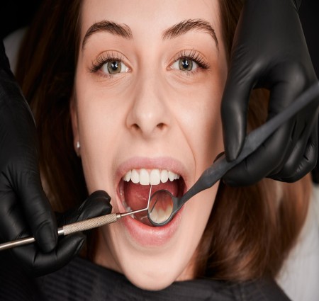 Gingivectomy Explained: Its Procedure   Benefits