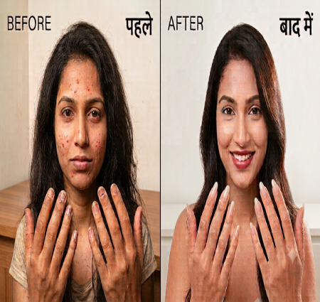 आइए जानते हैं घरेलू उपाय: बेदाग त्वचा  चमकदार बाल और मजबूत नाखून